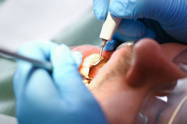 Best Emergency Denture Repair in Sullivan, IN