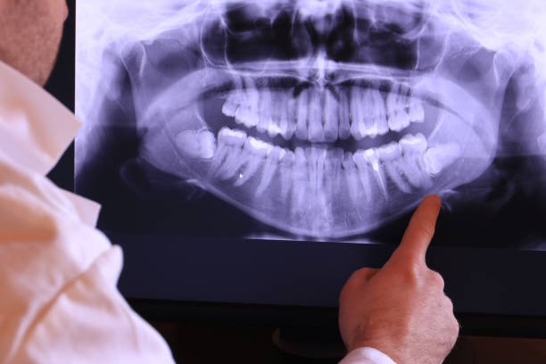 Best Emergency Gum Treatment in Sullivan, IN