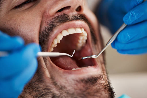 Best Emergency Root Canal Treatment in Sullivan, IN