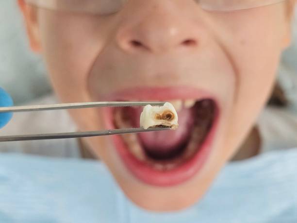 Best Weekend Emergency Dentist in Sullivan, IN