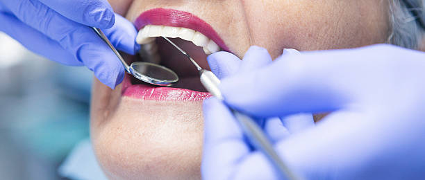 Best Emergency Treatment for Dental Infections or Abscesses in Sullivan, IN